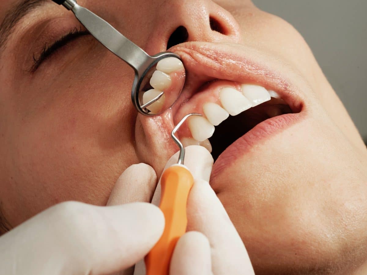Peur du dentiste : peut-on la vaincre ?