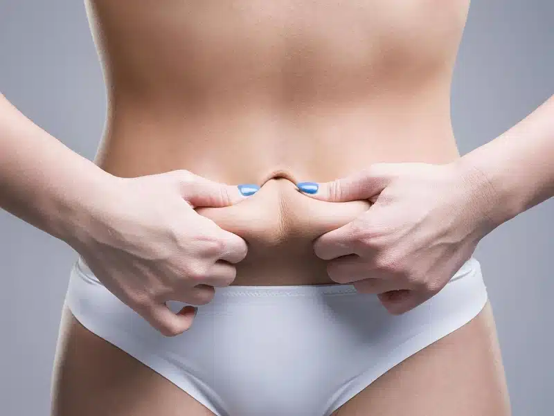 Abdominoplastie : quand la faire ?