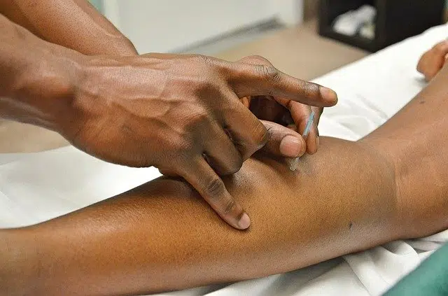 A quoi sert un acupuncteur ?